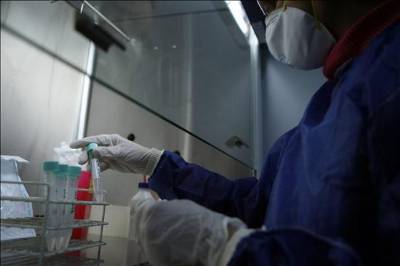 Girl of 18 dies of swine ‘flu