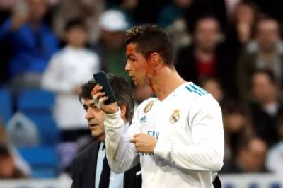 Ronaldo left with a 'shiner' after phone-mirror moment goes viral