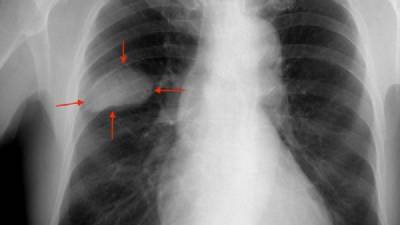 Medical science: Spain's latest 'Eureka' moments